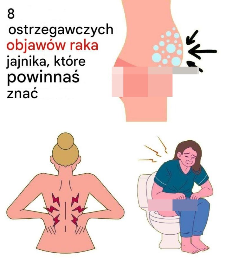 8 ostrzegawczych objawów raka jajnika, których nie należy ignorować