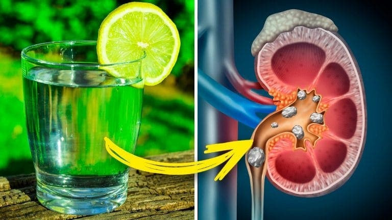 10 rzeczy, które cytryny robią z twoim ciałem, o których powinieneś wiedzieć