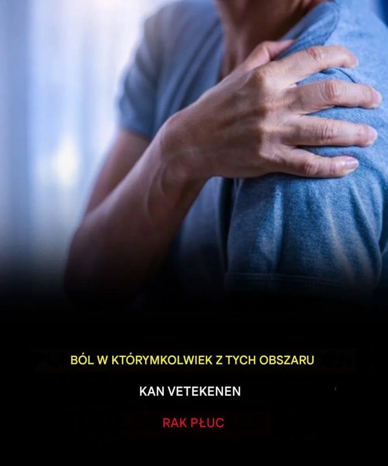 Ból w którymkolwiek z tych miejsc może być oznaką raka płuc.