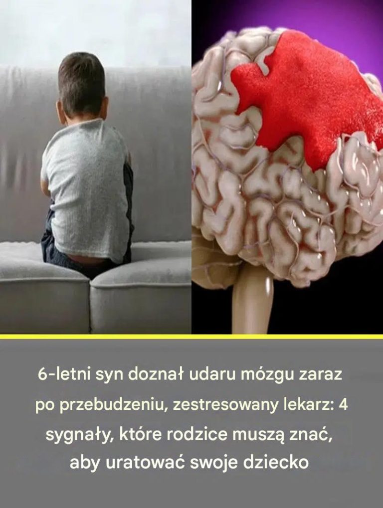 6-letni syn doznał udaru mózgu zaraz po przebudzeniu, zestresowany lekarz: 4 sygnały, które rodzice muszą znać, aby uratować swoje dziecko