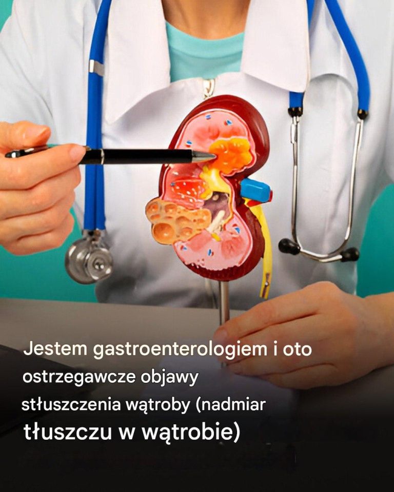 Jako gastroenterolog wyjaśnię Państwu pierwsze objawy, które mogą wskazywać na stłuszczenie wątroby, czyli nadmiar tłuszczu w wątrobie.