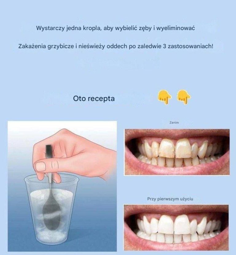 Usuń kamień nazębny i wybiel zęby dzięki temu prostemu przepisowi.