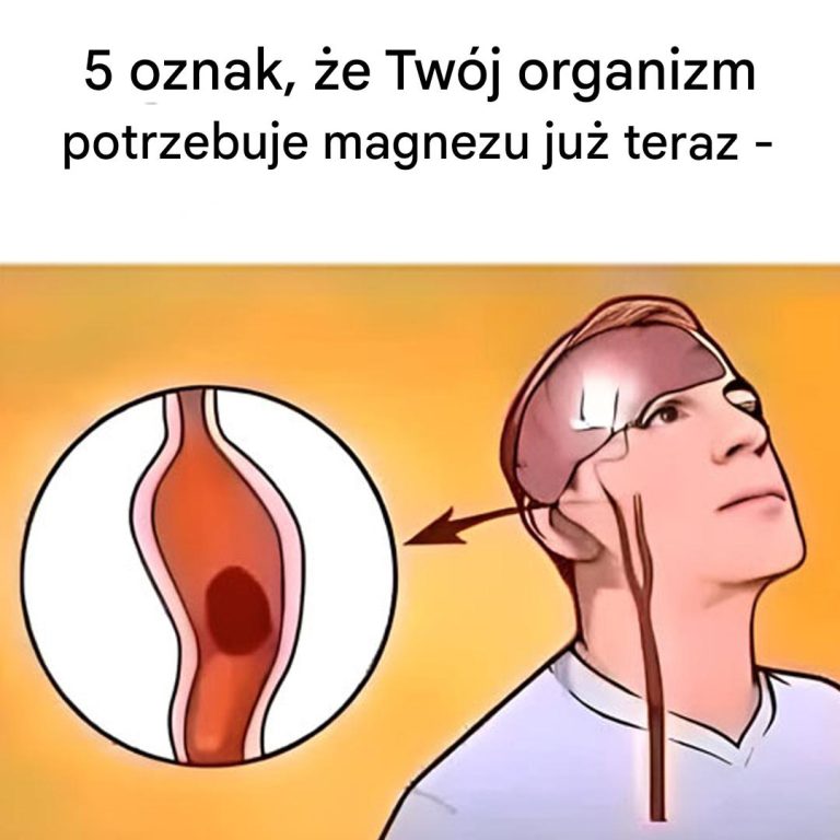 5 oznak, które mogą wskazywać na niedobór magnezu