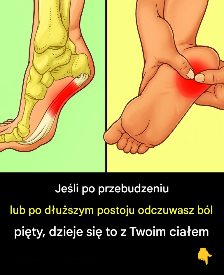 7 skutecznych ćwiczeń łagodzących ból pięty i leczących zapalenie powięzi podeszwowej w sposób naturalny