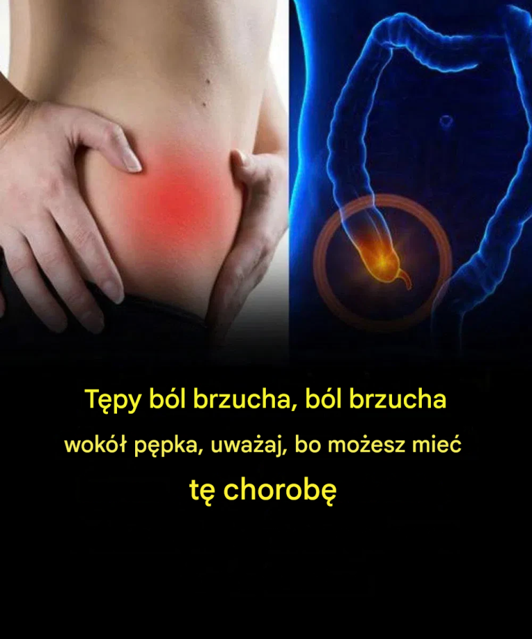 Tępy ból brzucha, ból brzucha wokół pępka, uważaj, bo możesz mieć tę chorobę