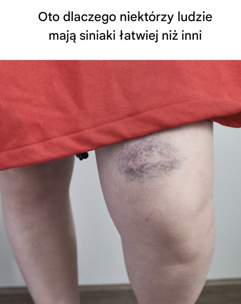 To mi się ciągle zdarza i nigdy nie wiedziałam dlaczego! Teraz już wiem! Wiedziałeś o tym?