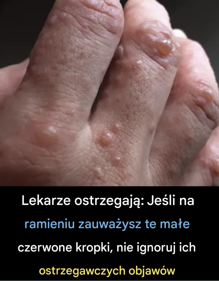 Nie ignoruj ​​tych małych czerwonych plamek na ramieniu – mogą być ważnymi znakami ostrzegawczymi