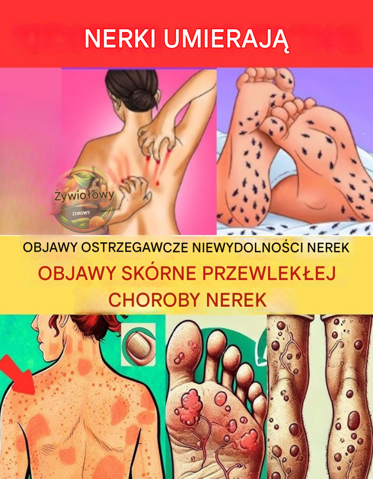 23 dziwne objawy choroby nerek, których większość ludzi nie zauważa — dopóki nie jest za późno