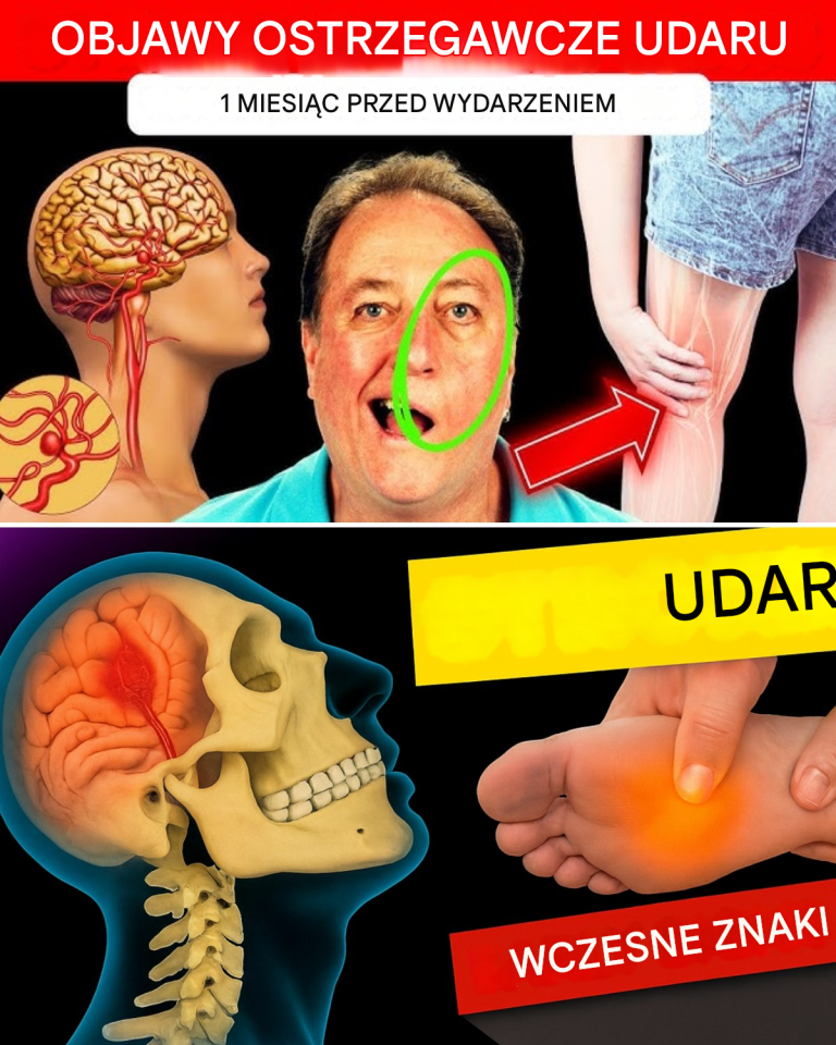 8 ostrzegawczych objawów udaru i 9 wskazówek, jak mu zapobiegać