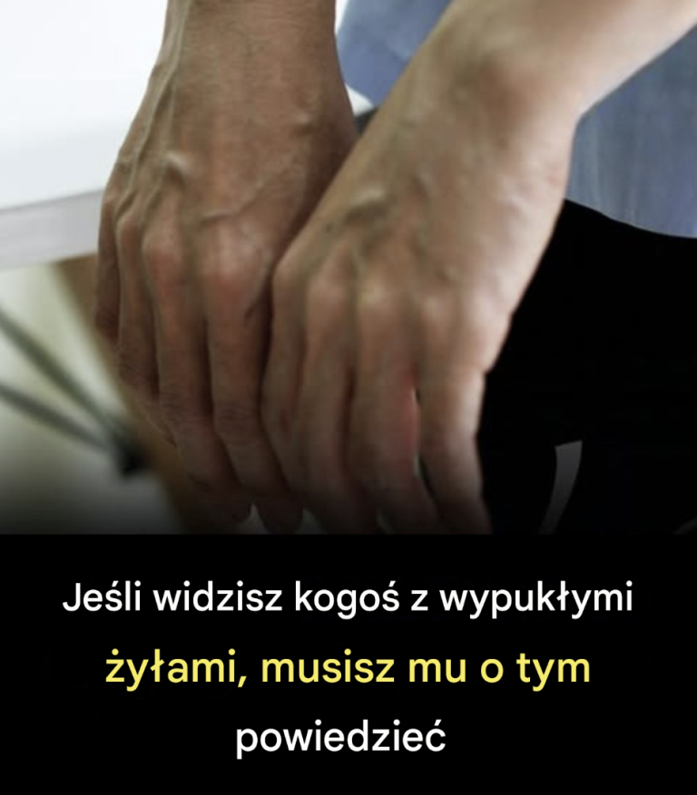 7 codziennych nawyków, które powodują, że Twoje żyły stają się bardziej widoczne