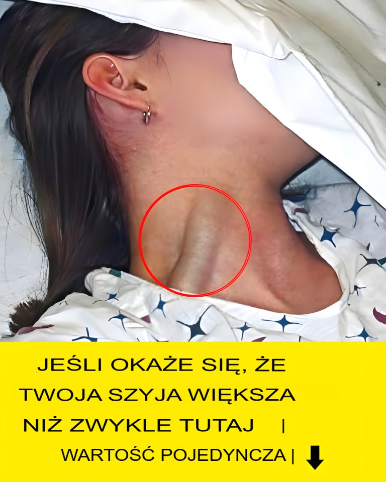 Czy zauważyłeś, że Twoja szyja wydaje się grubsza niż normalnie, bez przybierania na wadze i nieprawidłowej postawy?