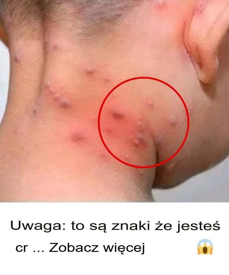 Najczęstsze wysypki skórne u osób starszych: przyczyny, objawy i leczenie