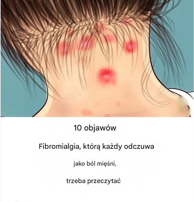 10 objawów fibromialgii, które powinien przeczytać każdy, kto cierpi na bóle mięśni