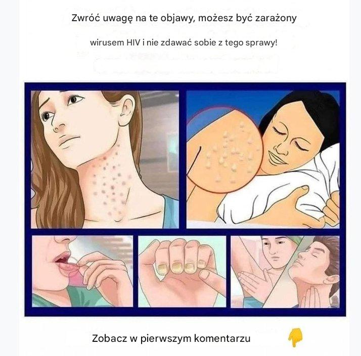 HIV: pierwsze objawy, których nie można ignorować.