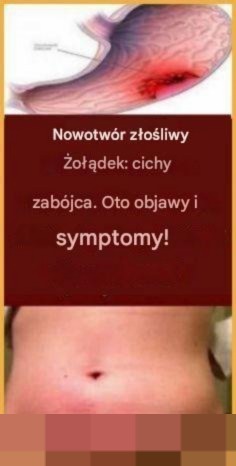 RAK ŻOŁĄDKA – CICHY ZABÓJCA. Oto jego objawy!
