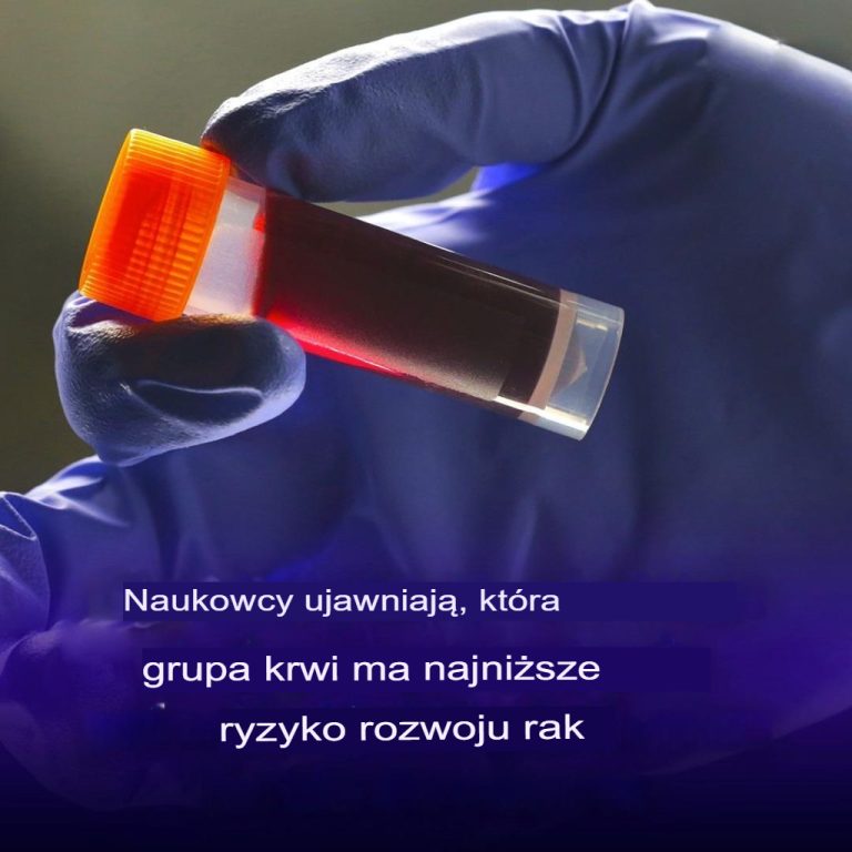 Naukowcy pokazują, która grupa krwi wiąże się z najniższym ryzykiem zachorowania na raka