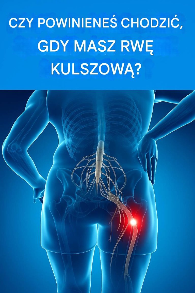 Czy można chodzić, mając rwę kulszową?