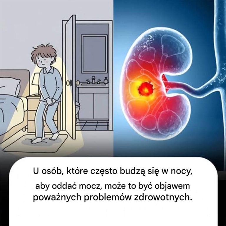 U osób, które budzą się w nocy częściej niż 2 razy, aby oddać mocz, może to być objawem tych problemów zdrowotnych