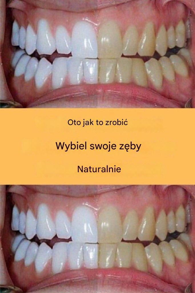 Pożegnaj się z przebarwieniami zębów dzięki tej prostej mieszance