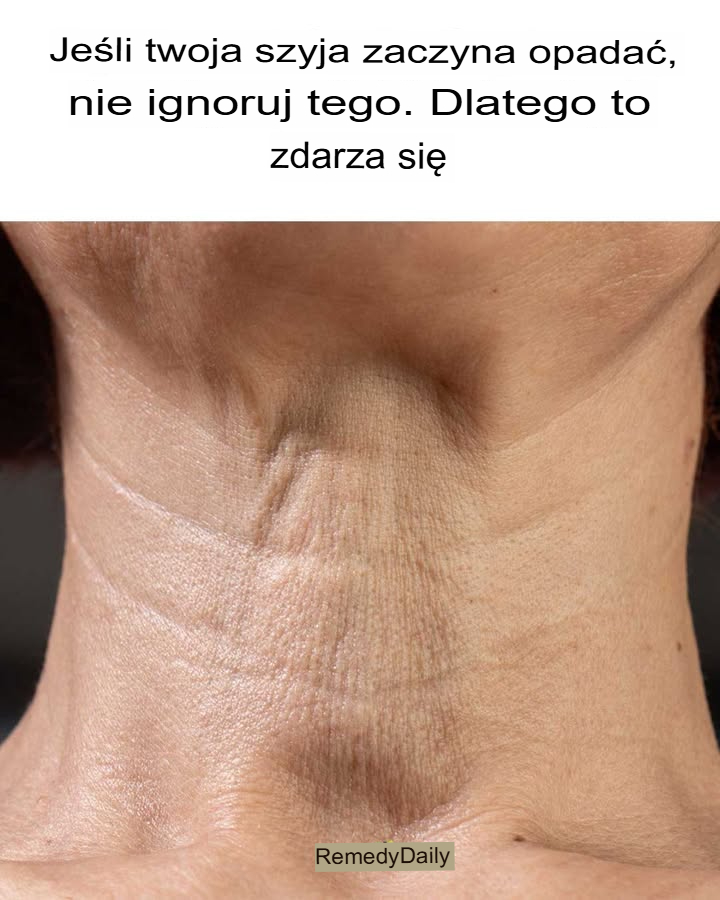 Jeśli Twoja szyja zaczyna opadać, nie ignoruj ​​tego. Oto przyczyna tego zjawiska.