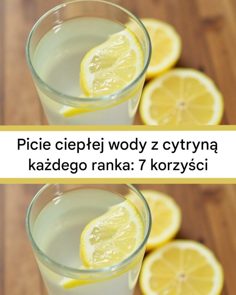 🍋 Picie ciepłej wody z cytryną każdego ranka: 7 korzyści, które zmienią Twoją rutynę