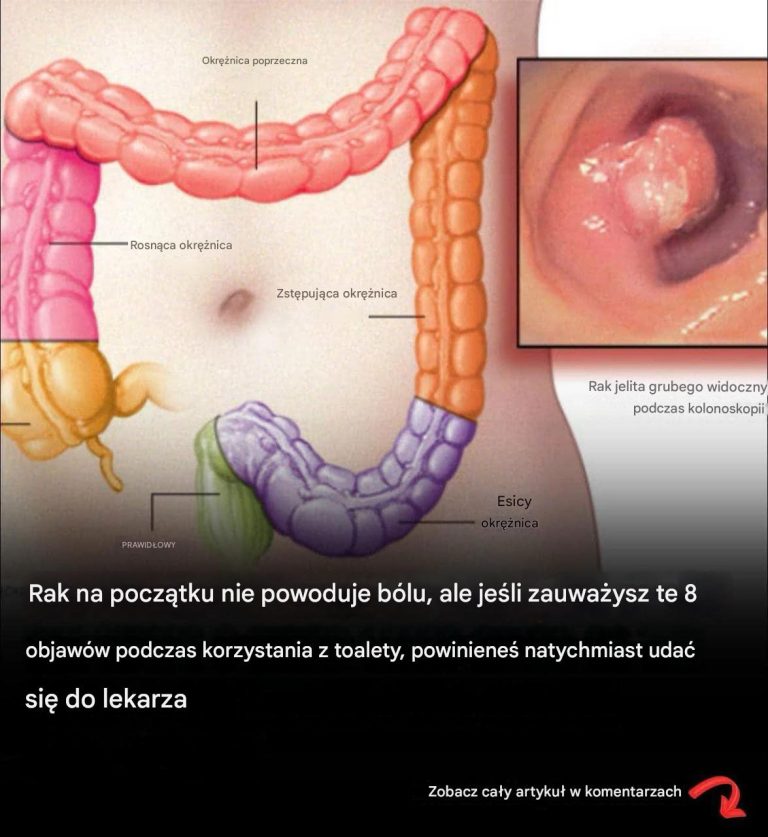 Ponad 40 dziwnych objawów, które mogą wskazywać na diagnozę raka