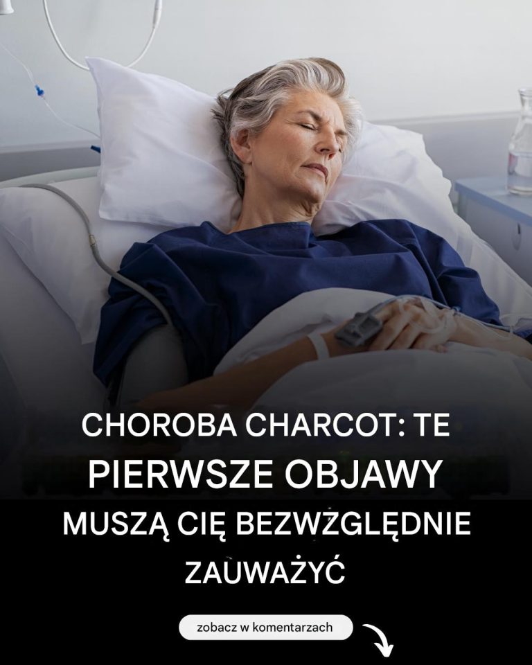 Choroba Lou Gehriga: oto pierwsze objawy tej choroby