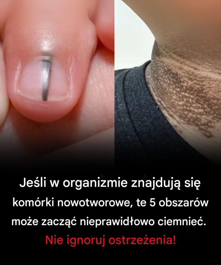 Jeśli w organizmie znajdują się komórki nowotworowe, te 5 obszarów może zacząć nieprawidłowo ciemnieć