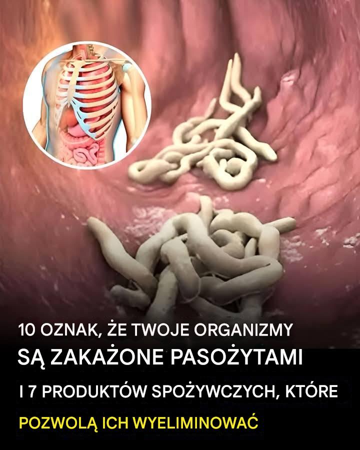 10 oznak, że w Twoim organizmie jest pełno pasożytów