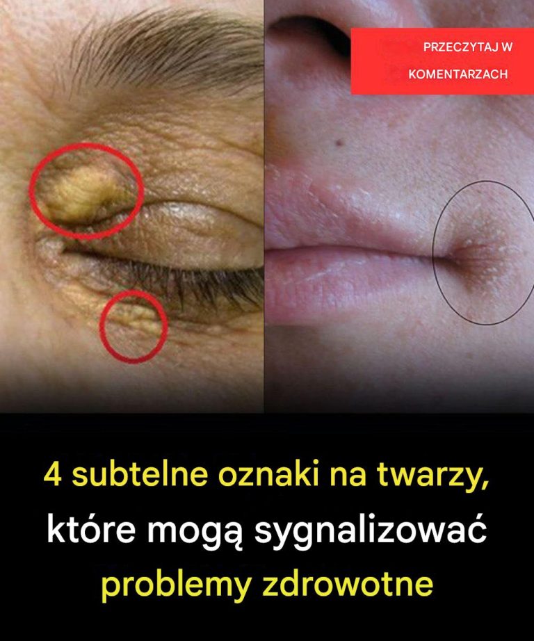 4 subtelne oznaki na twarzy, które mogą sygnalizować problemy zdrowotne