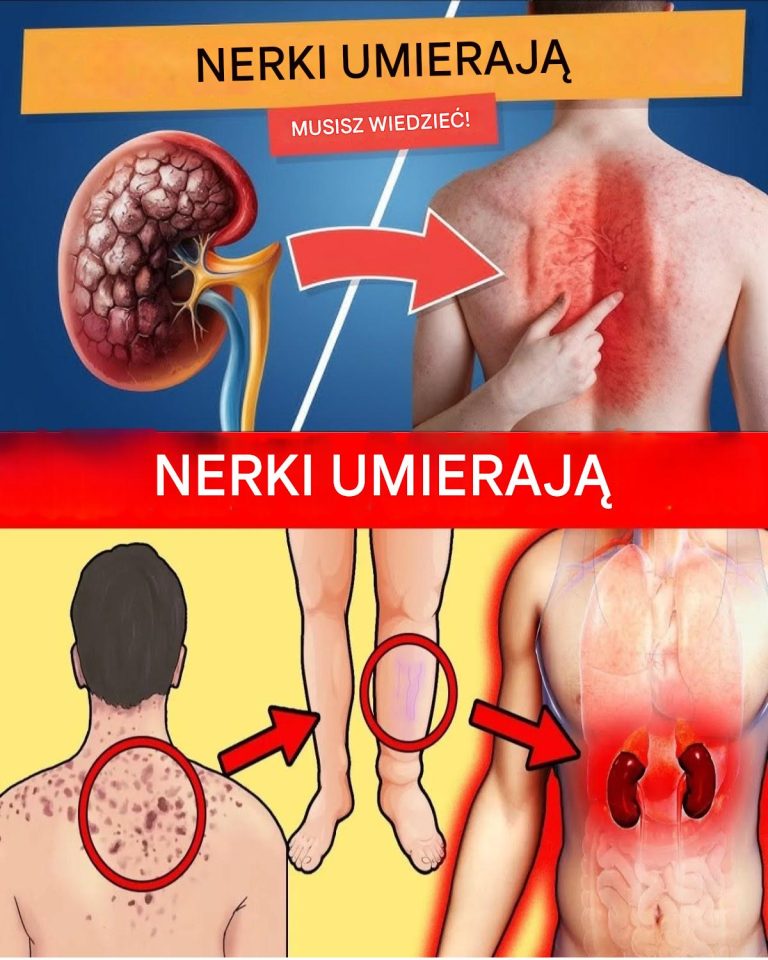 23 dziwne objawy choroby nerek, których możesz nie zauważyć